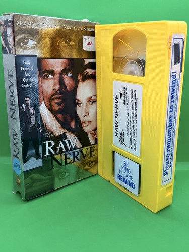 Raw nerve race car - nerve, 2000)